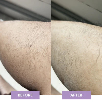 Crystal Smooth Hair Removal Eraser