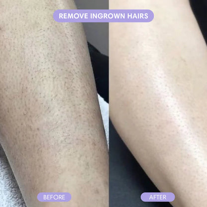 Crystal Smooth Hair Removal Eraser