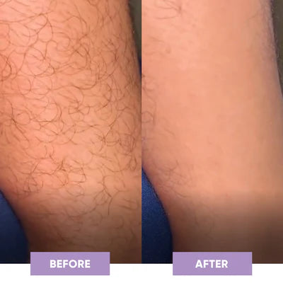Crystal Smooth Hair Removal Eraser