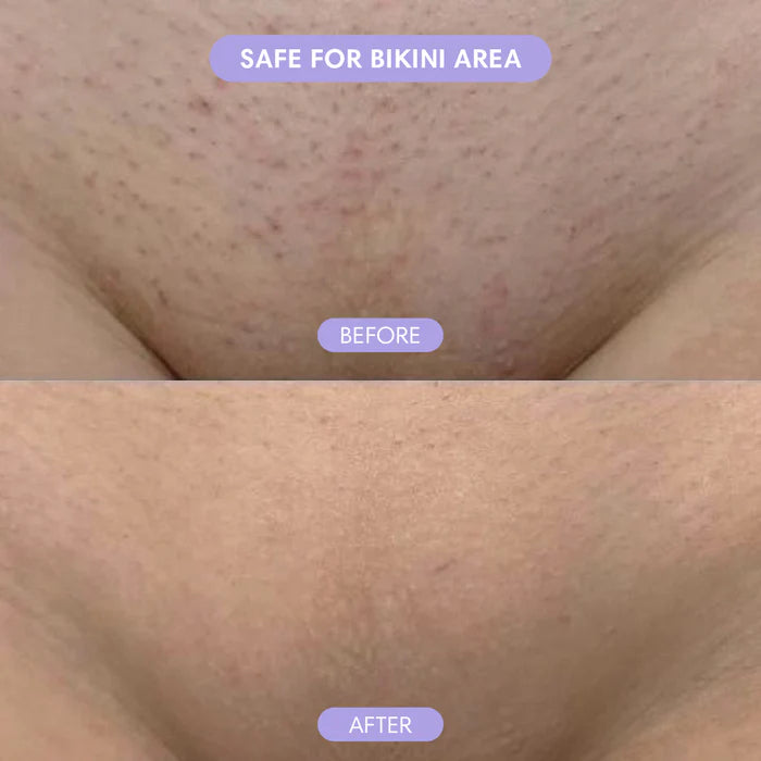 Crystal Smooth Hair Removal Eraser
