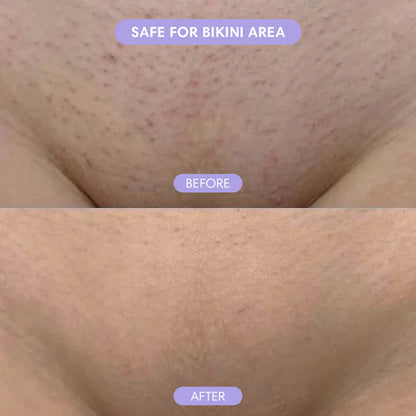 Crystal Smooth Hair Removal Eraser