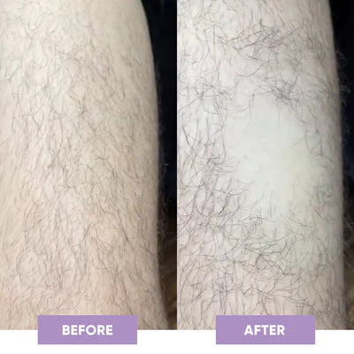 Crystal Smooth Hair Removal Eraser